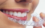 Fiksna proteza podgorica ~ Ortodontska ordinacija Dent-ES